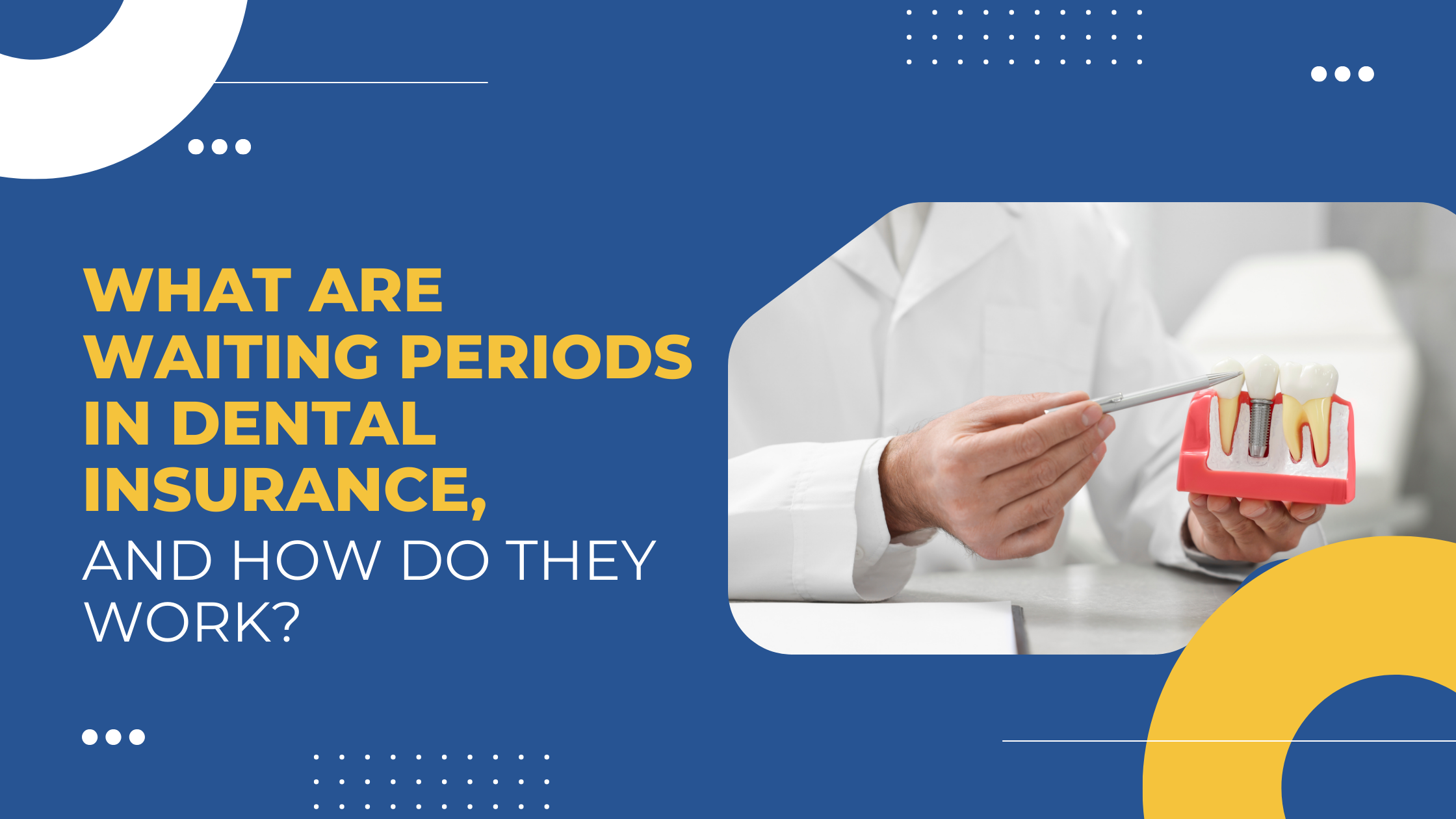 Read more about the article What Are Waiting Periods in Dental Insurance, and How Do They Work?