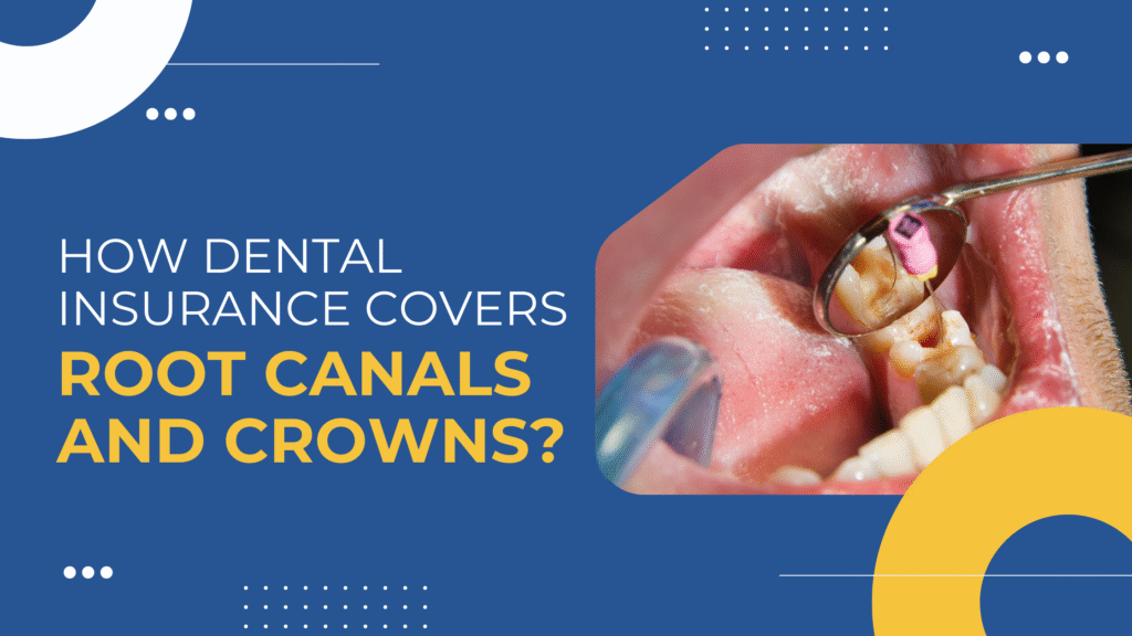 Dental Insurance Covers