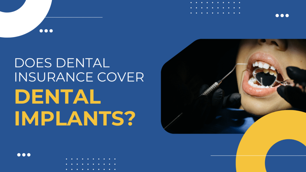 Dental Insurance Cover