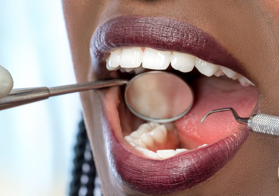 Best Dental Insurance Plans in Charlotte, NC Best Dental Insurance Plans in Charlotte, NC